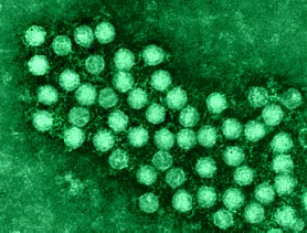 Enterovirus